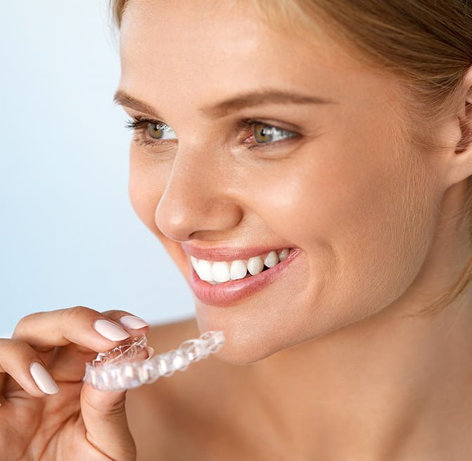 Invisalign For Overbite Teeth in Forest Hill